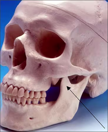 Maxillary Posterior Landmarks - Figure 4