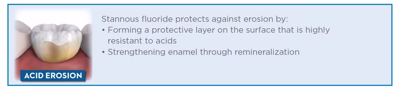 Stannous fluoride protects against erosion