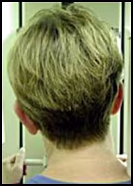 ce589 - Content - Incorrect Head Orientation - Figure 2